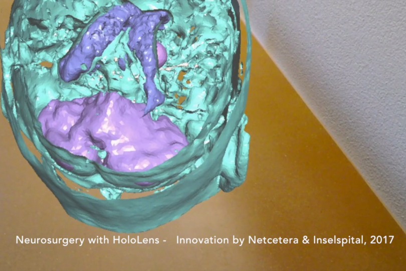 Einblick ins Gehirn dank 3D-Visualisierung