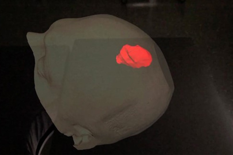 Der Chirurg sieht virtuell direkt in den Kopf des Patienten